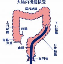 検査の方法