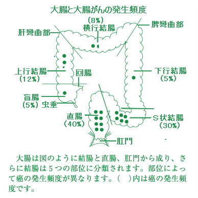 直腸 が ん 症状