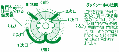 痔瘻の分類