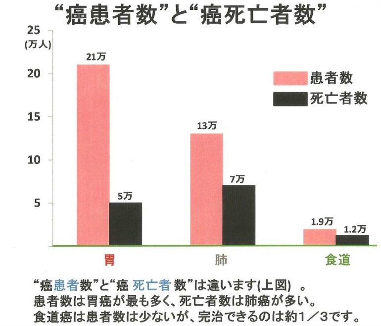 なぜ"胃カメラ“を受けるのが大切なのでしょう