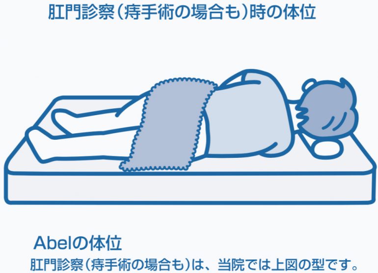 肛門科の受診案内